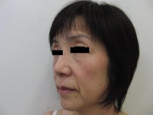 東京銀座 美容整形外科 美容皮膚科 レティシアクリニック