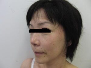 東京銀座 美容整形外科 美容皮膚科 レティシアクリニック