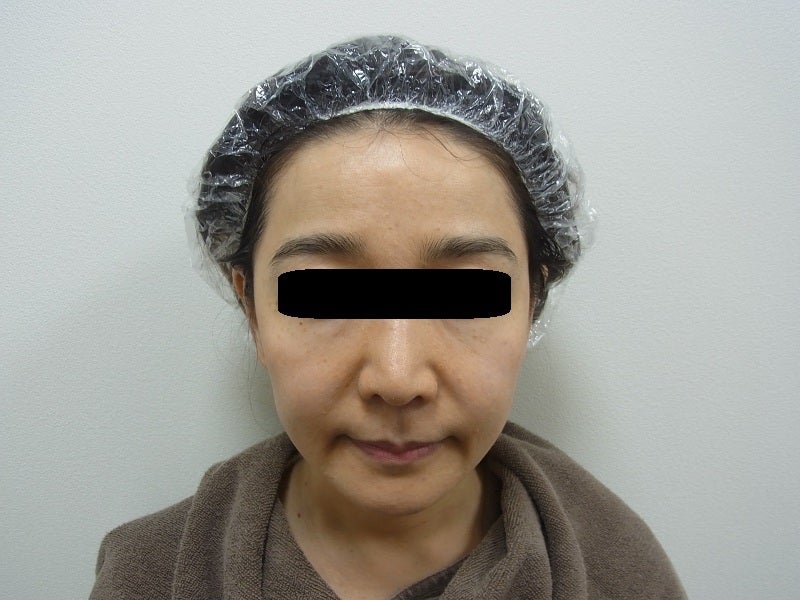 東京銀座　美容整形外科　美容皮膚科　レティシアクリニック