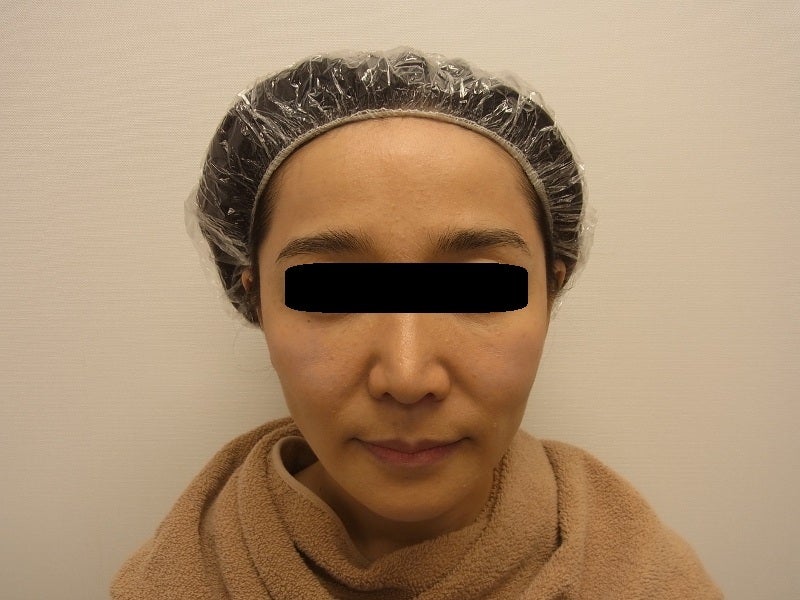 東京銀座　美容整形外科　美容皮膚科　レティシアクリニック