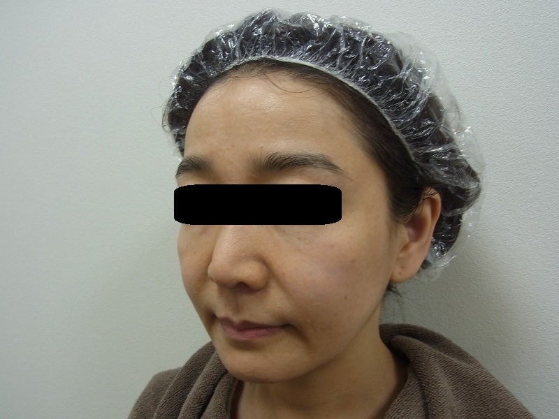 東京銀座　美容整形外科　美容皮膚科　レティシアクリニック