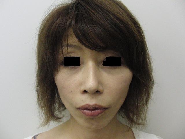 東京銀座　美容整形外科　美容皮膚科　レティシアクリニック