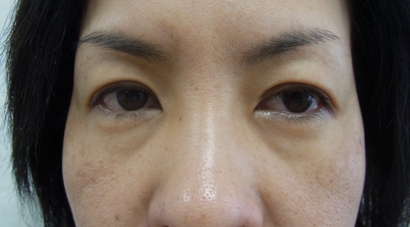 東京銀座　美容整形外科　美容皮膚科　レティシアクリニック