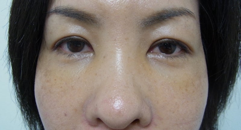 東京銀座　美容整形外科　美容皮膚科　レティシアクリニック