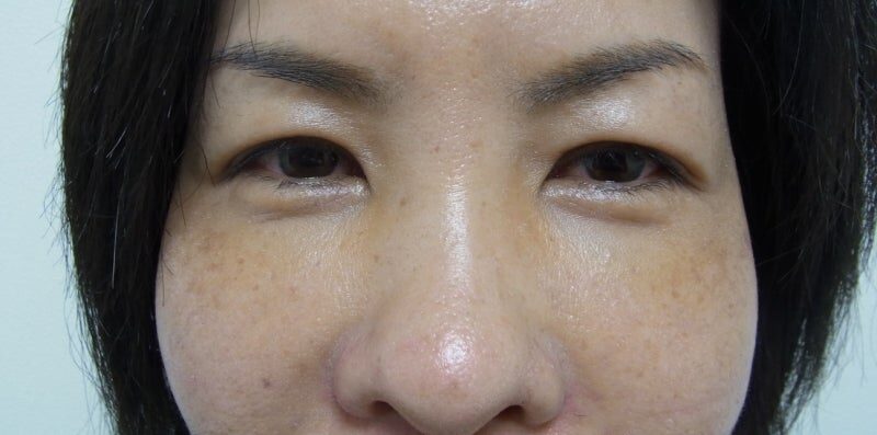 東京銀座　美容整形外科　美容皮膚科　レティシアクリニック