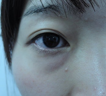 東京銀座　美容整形外科　美容皮膚科　レティシアクリニック