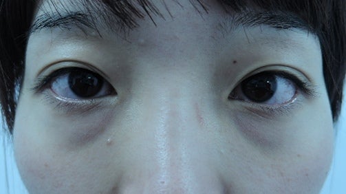 東京銀座　美容整形外科　美容皮膚科　レティシアクリニック