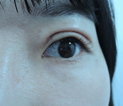 東京銀座　美容整形外科　美容皮膚科　レティシアクリニック