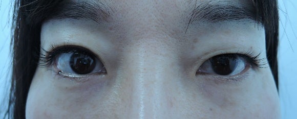 東京銀座　美容整形外科　美容皮膚科　レティシアクリニック