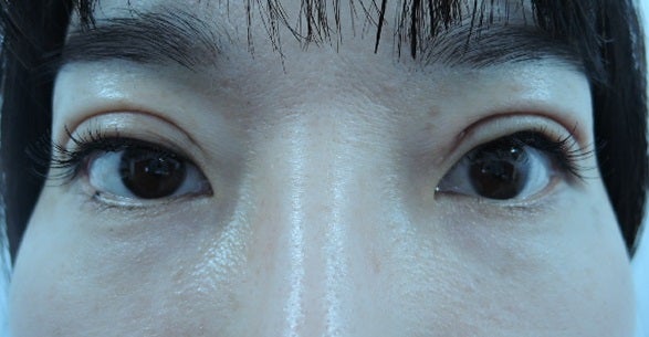 東京銀座　美容整形外科　美容皮膚科　レティシアクリニック