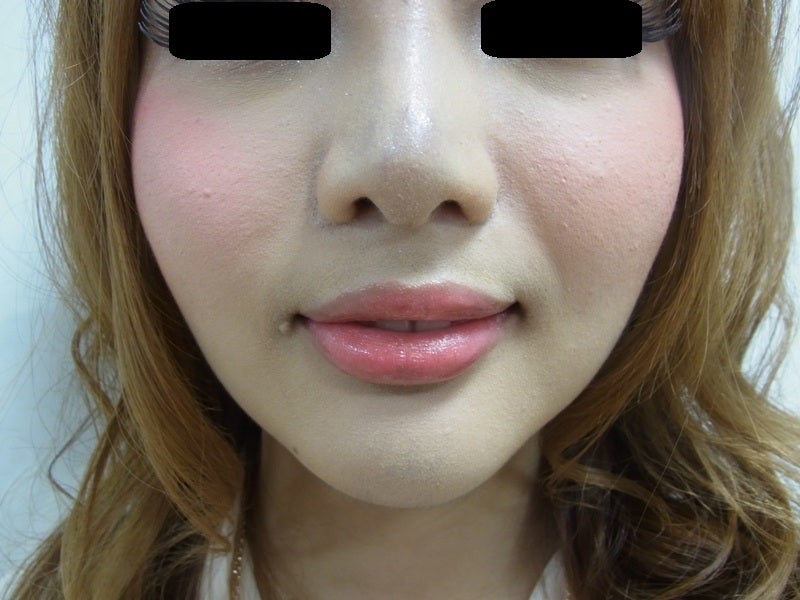 東京銀座　美容整形外科　美容皮膚科　レティシアクリニック