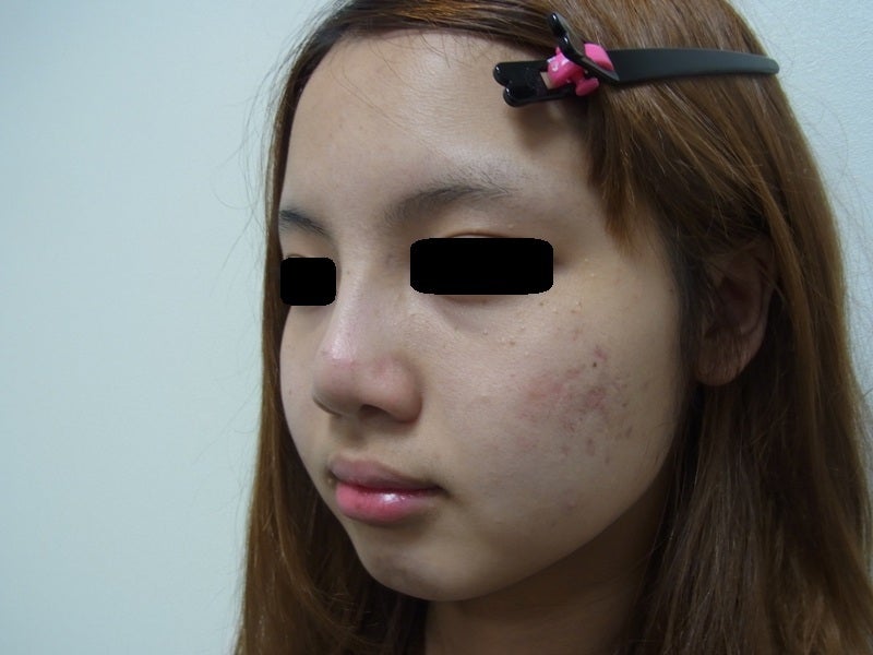 東京銀座　美容整形外科　美容皮膚科　レティシアクリニック