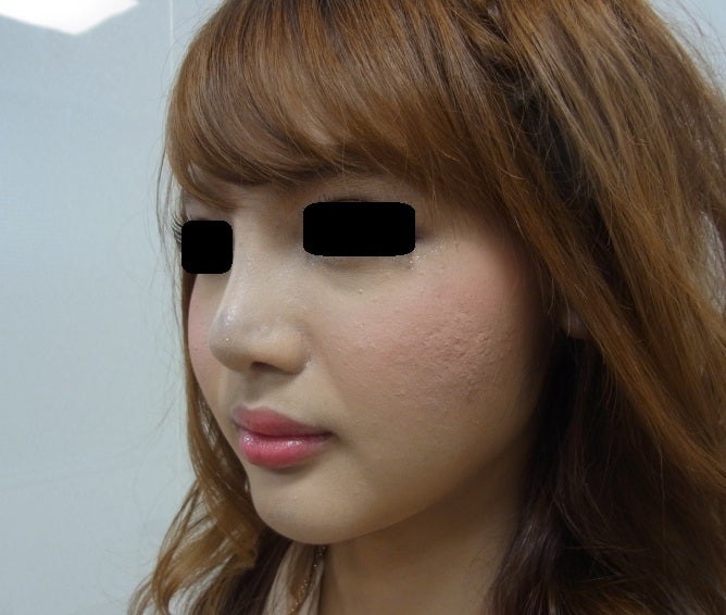 東京銀座　美容整形外科　美容皮膚科　レティシアクリニック