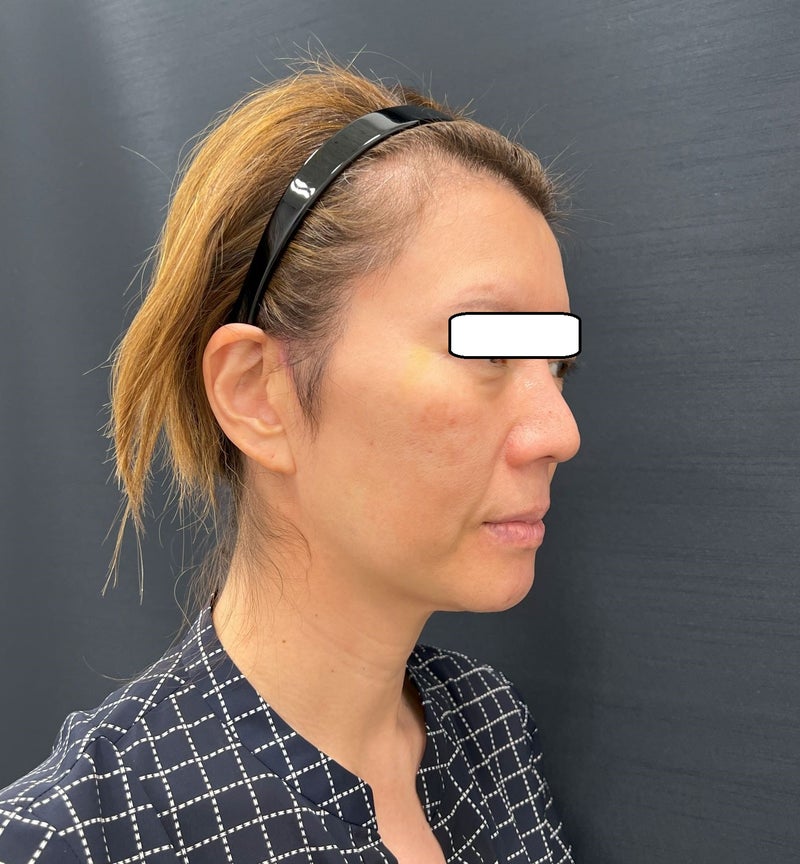 東京銀座 美容整形外科 美容皮膚科 レティシアクリニック