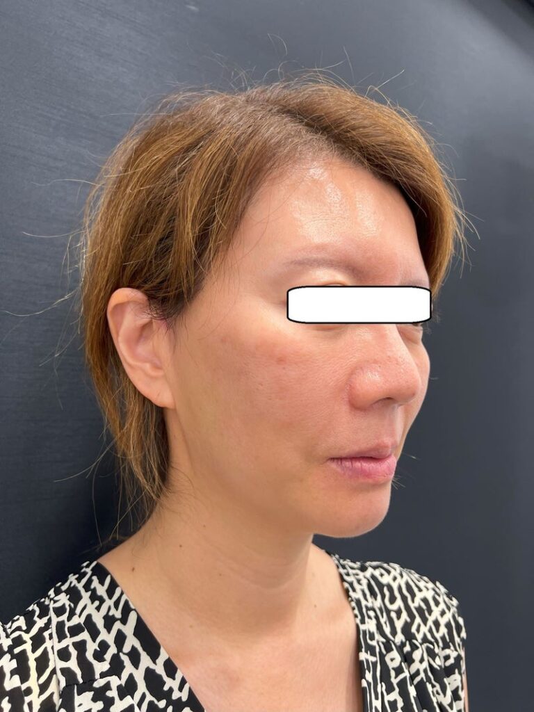 東京銀座 美容整形外科 美容皮膚科 レティシアクリニック