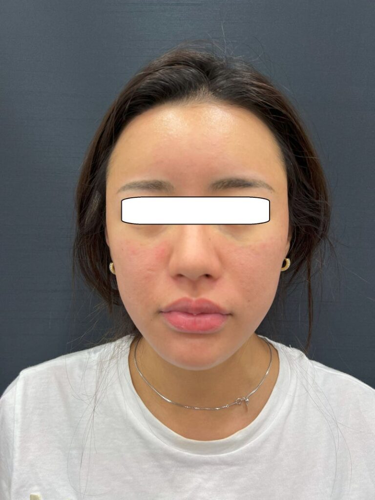 東京銀座 美容整形外科 美容皮膚科 レティシアクリニック