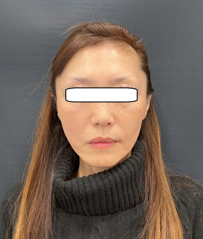 東京銀座 美容整形外科 美容皮膚科 レティシアクリニック