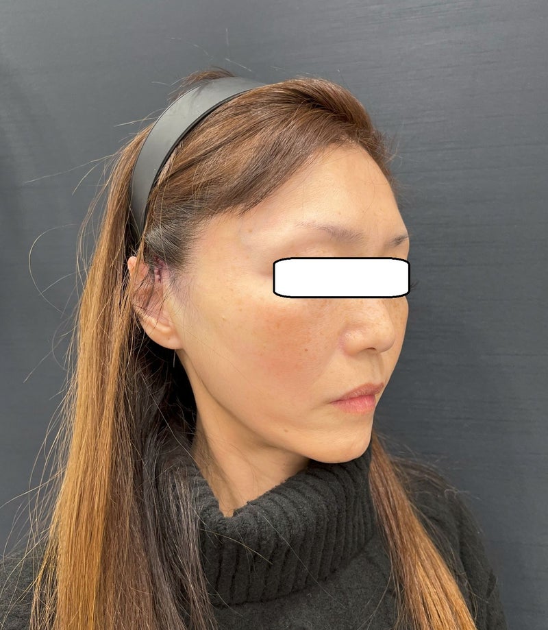 東京銀座 美容整形外科 美容皮膚科 レティシアクリニック