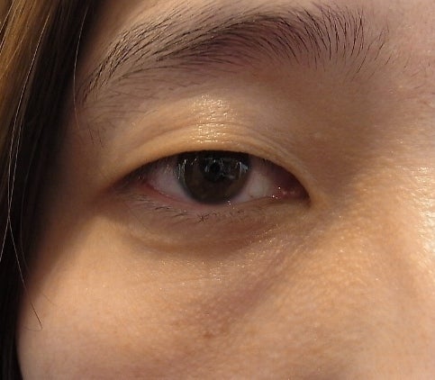 東京銀座　美容整形外科　美容皮膚科　レティシアクリニック