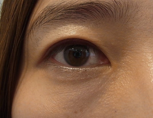 東京銀座　美容整形外科　美容皮膚科　レティシアクリニック