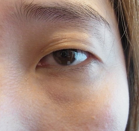 東京銀座　美容整形外科　美容皮膚科　レティシアクリニック