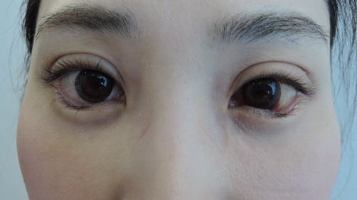 東京銀座　美容整形外科　美容皮膚科　レティシアクリニック