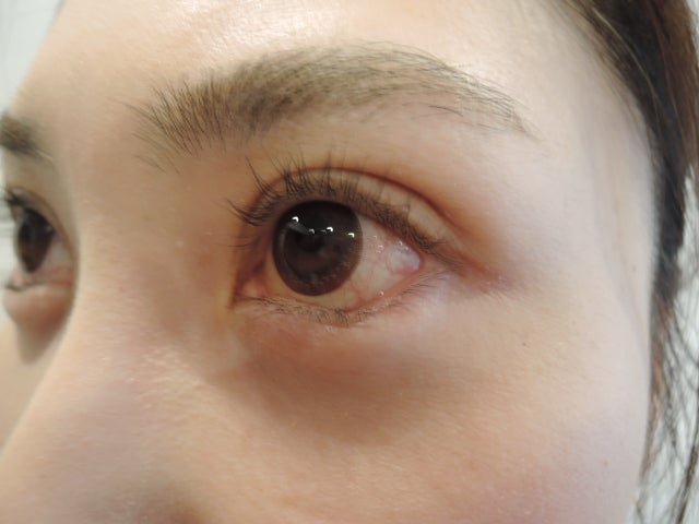 東京銀座　美容整形外科　美容皮膚科　レティシアクリニック