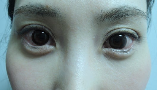 東京銀座　美容整形外科　美容皮膚科　レティシアクリニック