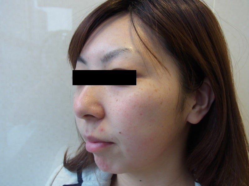 東京銀座 美容整形外科 美容皮膚科 レティシアクリニック