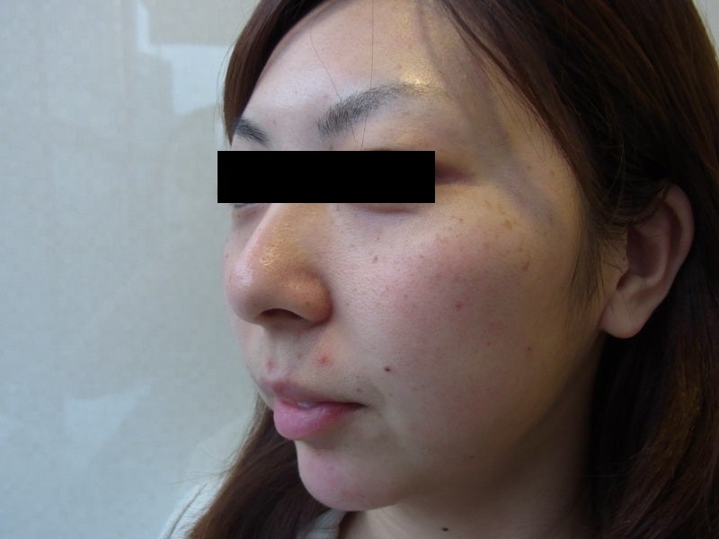 東京銀座 美容整形外科 美容皮膚科 レティシアクリニック