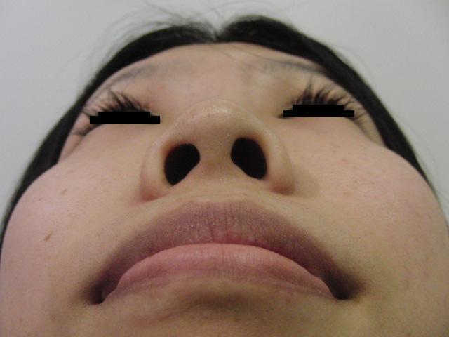 東京銀座　美容整形外科　美容皮膚科　レティシアクリニック