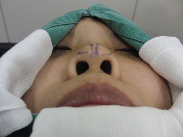 東京銀座　美容整形外科　美容皮膚科　レティシアクリニック