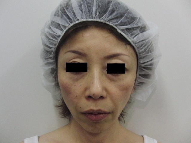 東京銀座　美容整形外科　美容皮膚科　レティシアクリニック