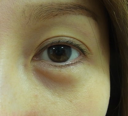 東京銀座 美容整形外科 美容皮膚科 レティシアクリニック