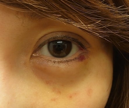 東京銀座 美容整形外科 美容皮膚科 レティシアクリニック