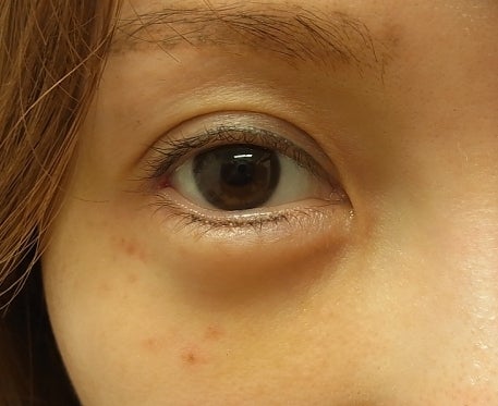 東京銀座 美容整形外科 美容皮膚科 レティシアクリニック