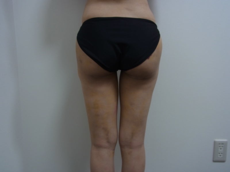 東京銀座 美容整形外科 美容皮膚科 レティシアクリニック