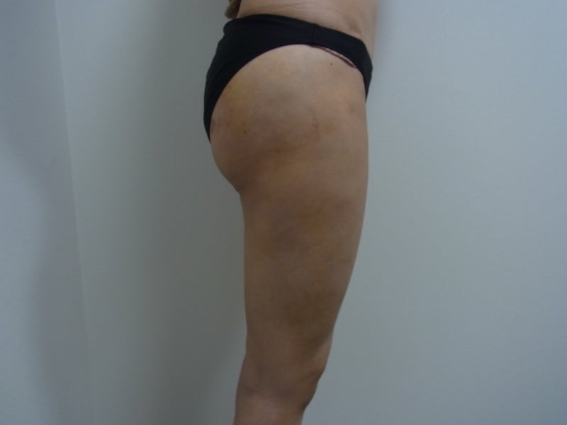 東京銀座 美容整形外科 美容皮膚科 レティシアクリニック