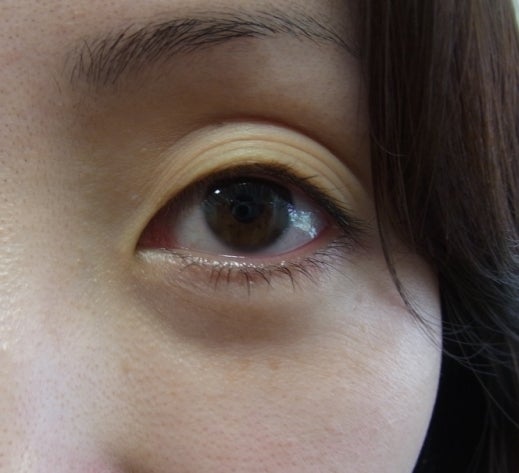 東京銀座　美容整形外科　美容皮膚科　レティシアクリニック