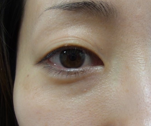 東京銀座　美容整形外科　美容皮膚科　レティシアクリニック