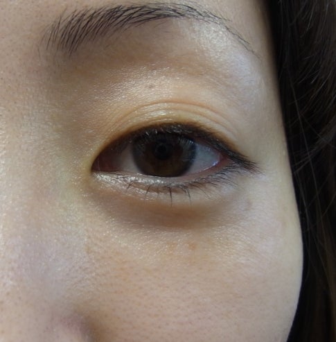 東京銀座　美容整形外科　美容皮膚科　レティシアクリニック