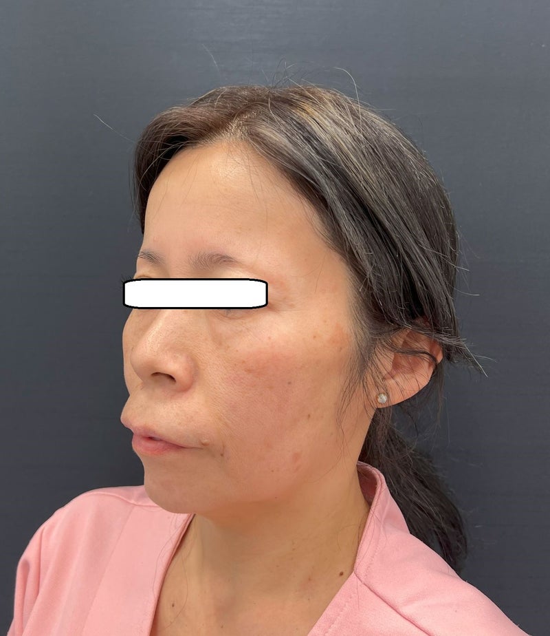 東京銀座 美容整形外科 美容皮膚科 レティシアクリニック