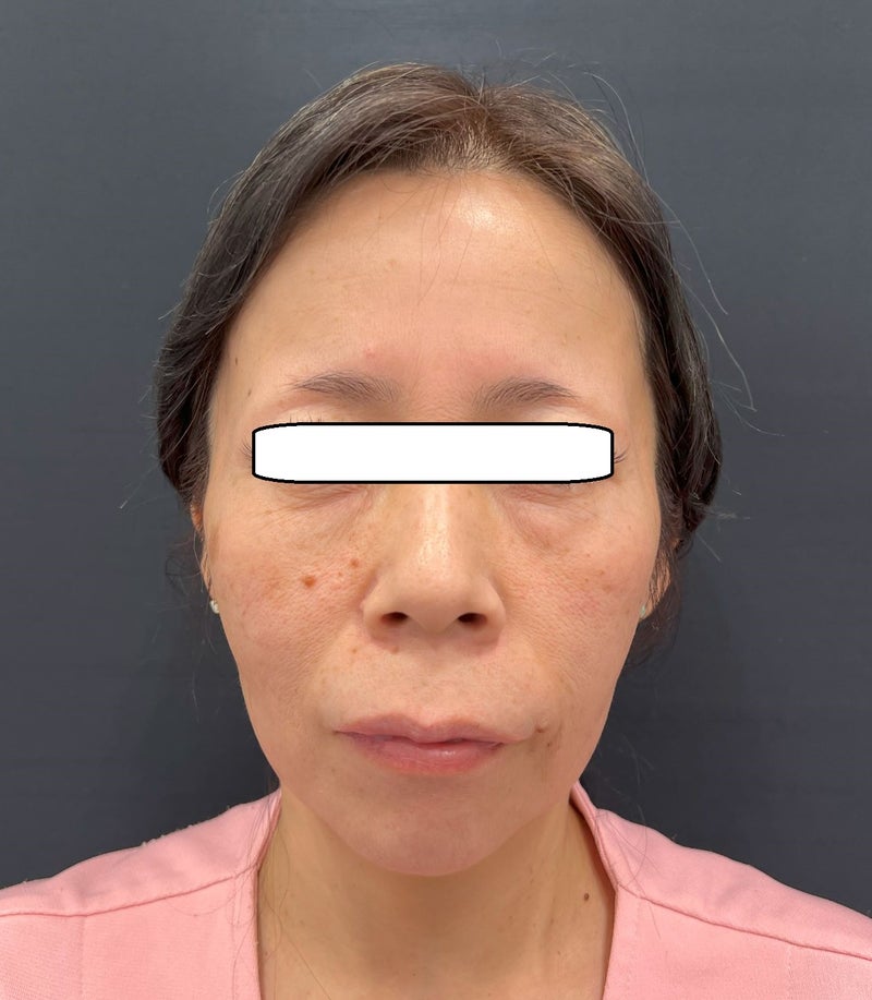 東京銀座 美容整形外科 美容皮膚科 レティシアクリニック