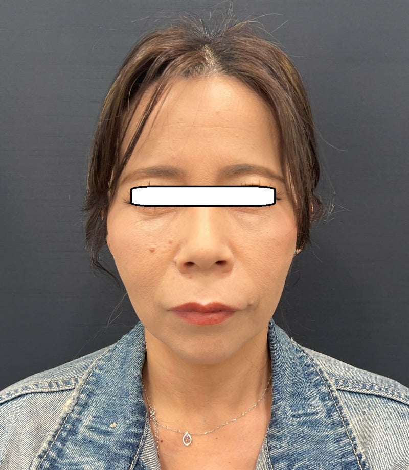 東京銀座 美容整形外科 美容皮膚科 レティシアクリニック