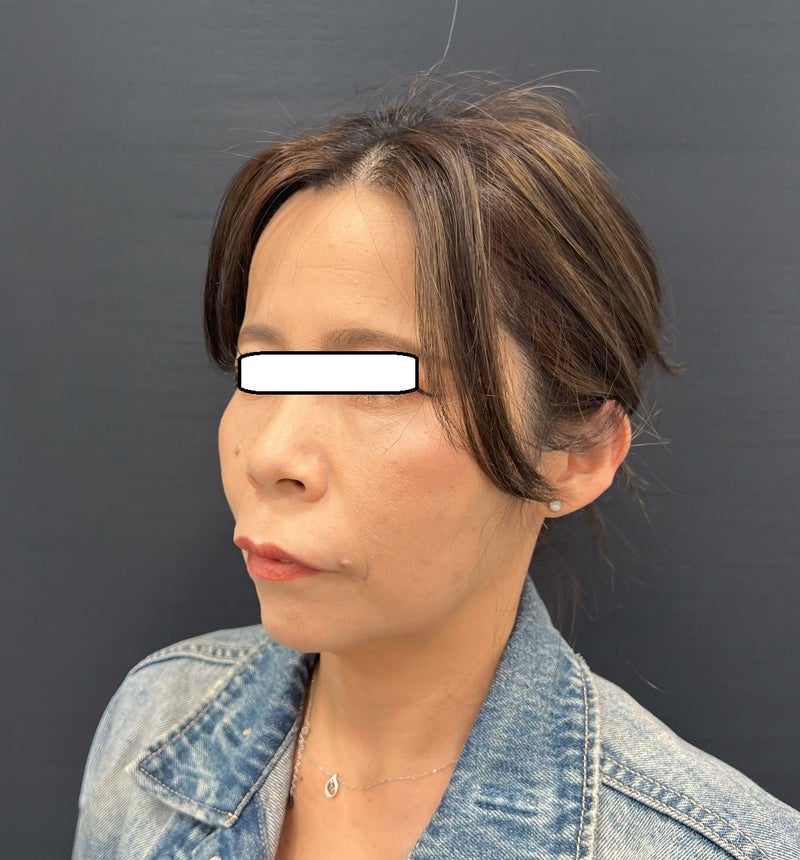 東京銀座 美容整形外科 美容皮膚科 レティシアクリニック