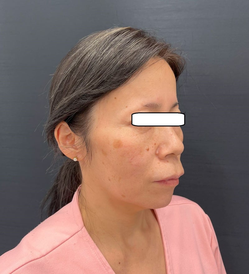 東京銀座 美容整形外科 美容皮膚科 レティシアクリニック