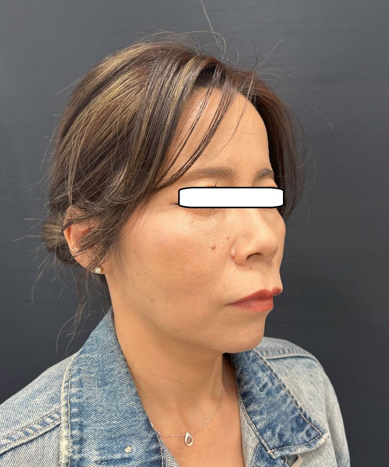 東京銀座 美容整形外科 美容皮膚科 レティシアクリニック