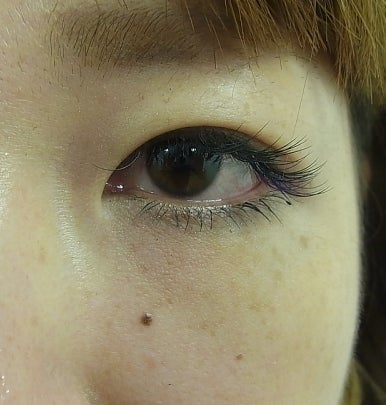 東京銀座 美容整形外科 美容皮膚科 レティシアクリニック