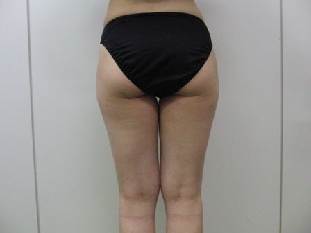 東京銀座 美容整形外科 美容皮膚科 レティシアクリニック