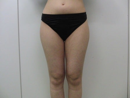 東京銀座 美容整形外科 美容皮膚科 レティシアクリニック